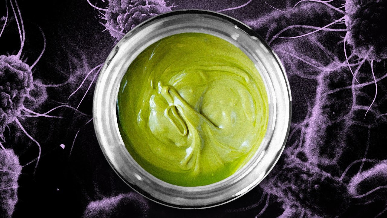 Salmonella outbreak: CDC warns consumers not to eat pistachio cream linked to infections of 4 people